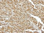 HSC70 Antibody in Immunohistochemistry (Paraffin) (IHC (P))