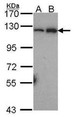 NFkB p52 Antibody in Western Blot (WB)