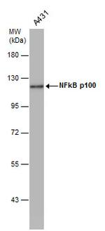 NFkB p52 Antibody in Western Blot (WB)