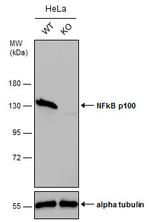 NFkB p52 Antibody