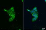 LIPA Antibody in Immunocytochemistry (ICC/IF)