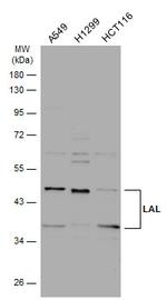 LIPA Antibody in Western Blot (WB)