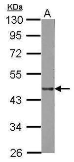 LIPA Antibody in Western Blot (WB)