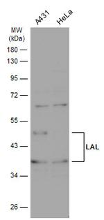 LIPA Antibody in Western Blot (WB)