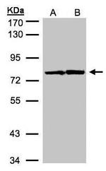 HADHA Antibody in Western Blot (WB)