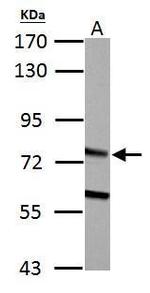 HADHA Antibody in Western Blot (WB)