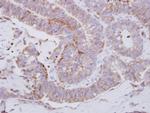 Lyn Antibody in Immunohistochemistry (Paraffin) (IHC (P))