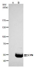 Lyn Antibody in Immunoprecipitation (IP)