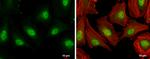 E2F1 Antibody in Immunocytochemistry (ICC/IF)