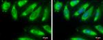 EIF2S1 Antibody in Immunocytochemistry (ICC/IF)