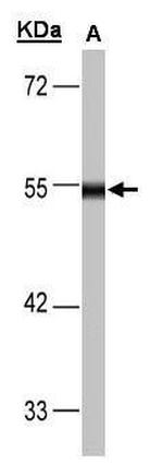 DLD Antibody in Western Blot (WB)