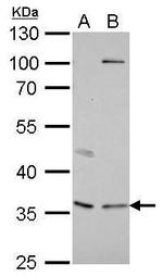 Decorin Antibody in Western Blot (WB)