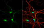 DTNBP1 Antibody in Immunocytochemistry (ICC/IF)