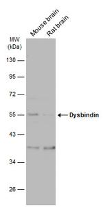 DTNBP1 Antibody in Western Blot (WB)