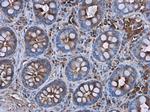 CRP Antibody in Immunohistochemistry (Paraffin) (IHC (P))