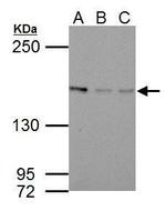 Blooms Syndrome Antibody in Western Blot (WB)