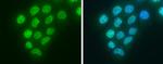 Blooms Syndrome Antibody in Immunocytochemistry (ICC/IF)