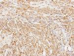 Butyrylcholinesterase Antibody in Immunohistochemistry (Paraffin) (IHC (P))