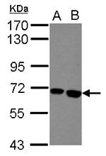 Butyrylcholinesterase Antibody in Western Blot (WB)