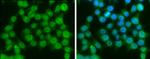 Ataxin 3 Antibody in Immunocytochemistry (ICC/IF)