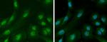 Ataxin 3 Antibody in Immunocytochemistry (ICC/IF)