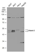 Ataxin 3 Antibody in Western Blot (WB)