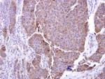 ADAM17 Antibody in Immunohistochemistry (Paraffin) (IHC (P))