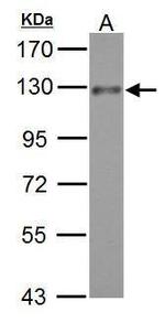 ADAM17 Antibody in Western Blot (WB)