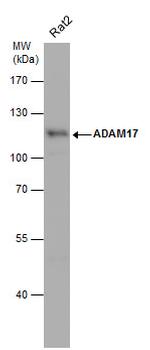 ADAM17 Antibody in Western Blot (WB)