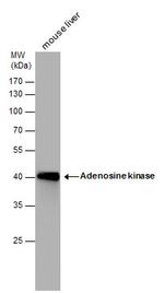 Adenosine Kinase Antibody in Western Blot (WB)