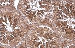 PGK1 Antibody in Immunohistochemistry (Paraffin) (IHC (P))