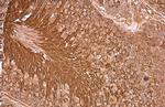 PGK1 Antibody in Immunohistochemistry (Paraffin) (IHC (P))