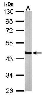 PGK1 Antibody in Western Blot (WB)