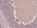 ABAT Antibody in Immunohistochemistry (Paraffin) (IHC (P))