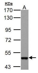 ABAT Antibody in Western Blot (WB)