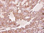 RhoGDI Antibody in Immunohistochemistry (Paraffin) (IHC (P))