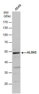 ALDH2 Antibody in Western Blot (WB)