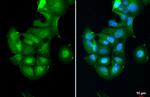 CK2 beta Antibody in Immunocytochemistry (ICC/IF)