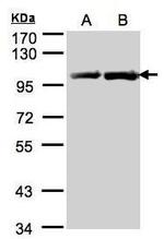 HSP90 beta Antibody in Western Blot (WB)