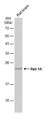 RAB1A Antibody in Western Blot (WB)