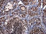 UAP56 Antibody in Immunohistochemistry (Paraffin) (IHC (P))