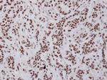 UAP56 Antibody in Immunohistochemistry (Paraffin) (IHC (P))