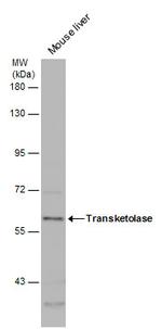 Transketolase Antibody in Western Blot (WB)