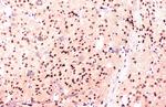 hnRNP A1 Antibody in Immunohistochemistry (Paraffin) (IHC (P))