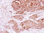 KNP-I Antibody in Immunohistochemistry (Paraffin) (IHC (P))