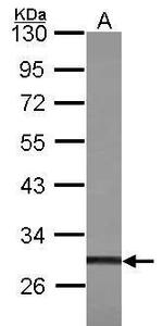 ZFP36L1 Antibody in Western Blot (WB)