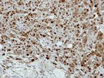 CRABP2 Antibody in Immunohistochemistry (Paraffin) (IHC (P))