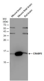 CRABP2 Antibody in Western Blot (WB)
