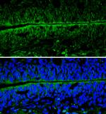 NSE Antibody in Immunohistochemistry (Frozen) (IHC (F))