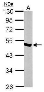 NSE Antibody in Western Blot (WB)